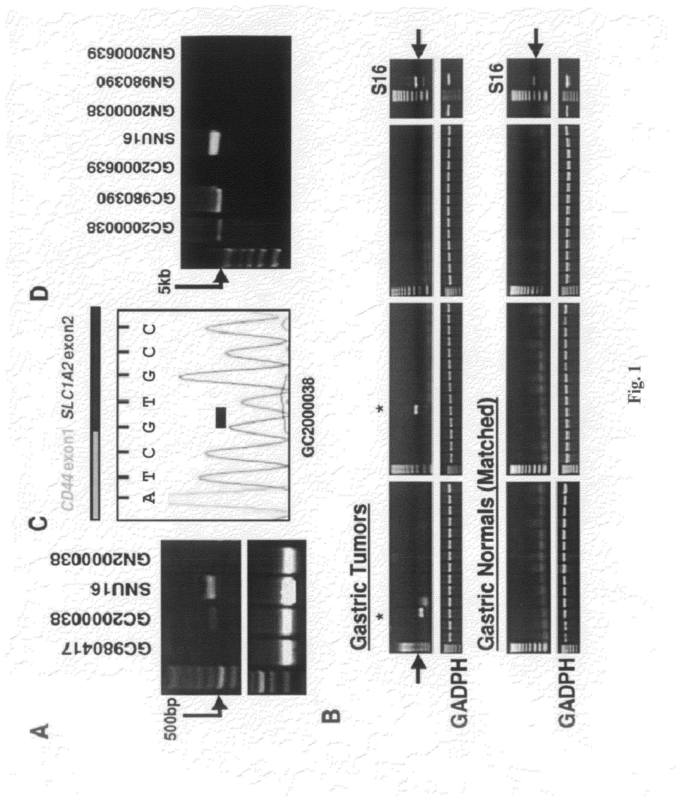 Fusion genes in gastrointestinal cancer