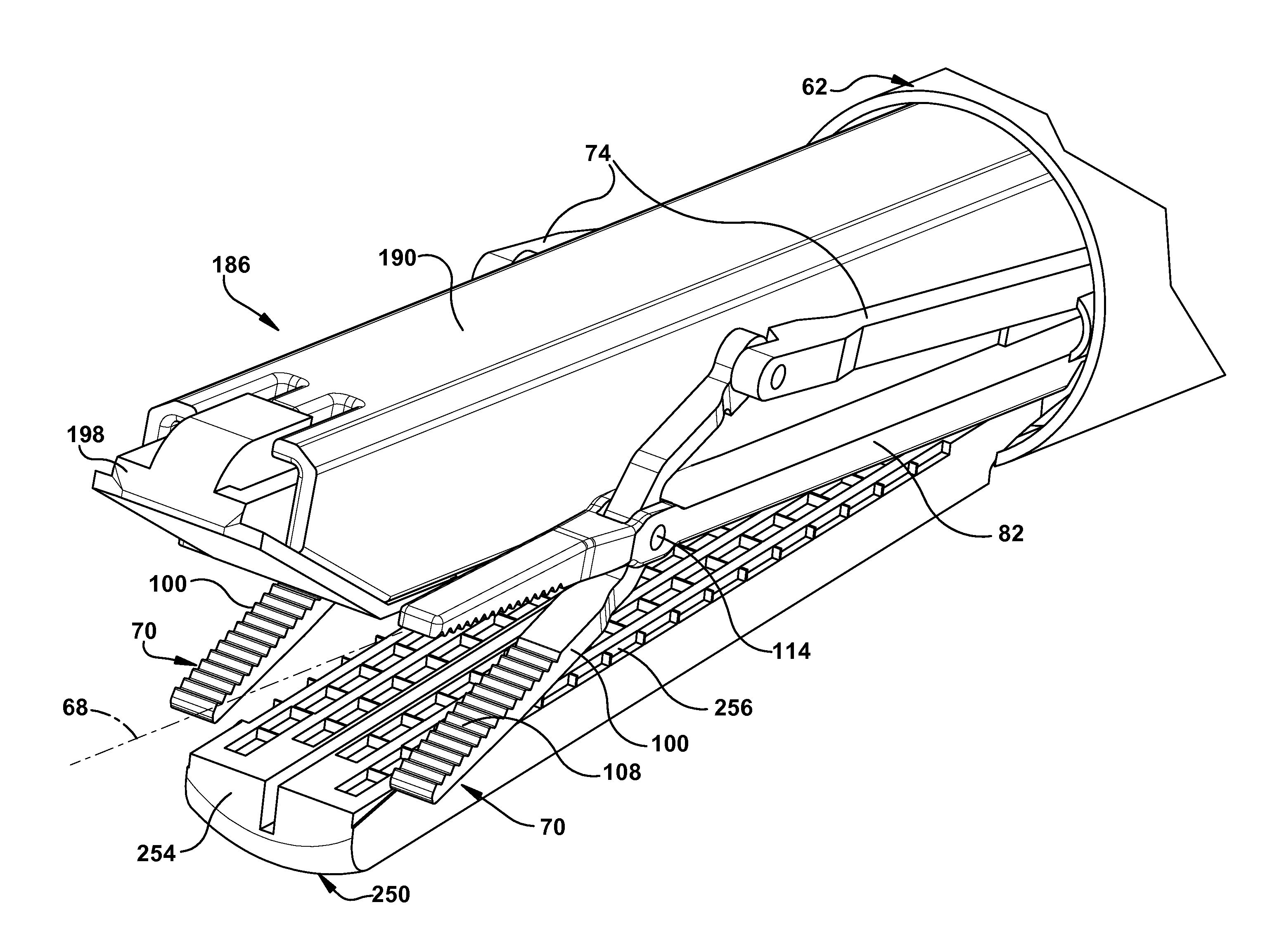 Endoscopic stapler