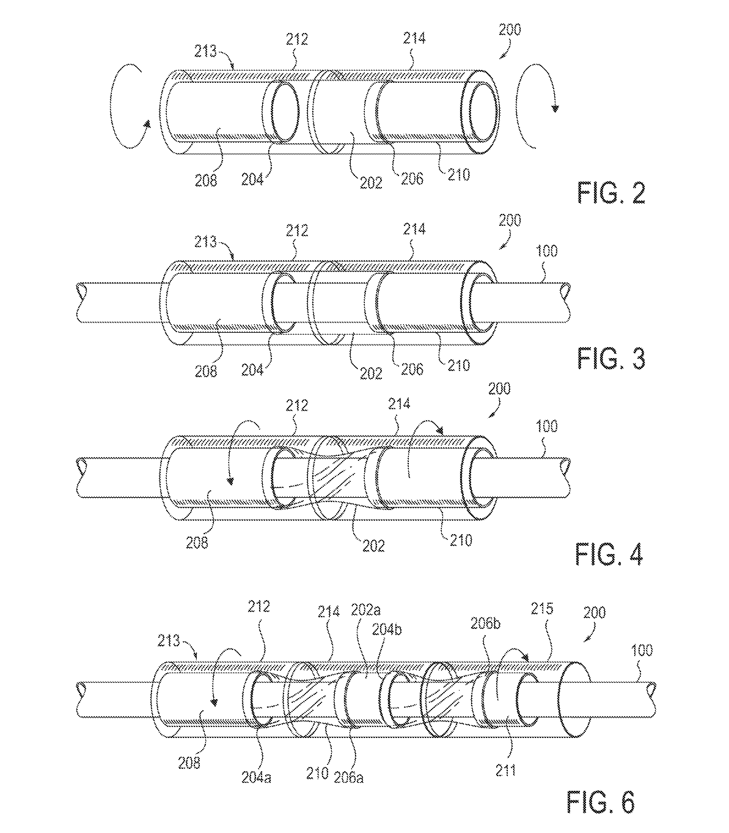 Twist-grip anchors and methods of use