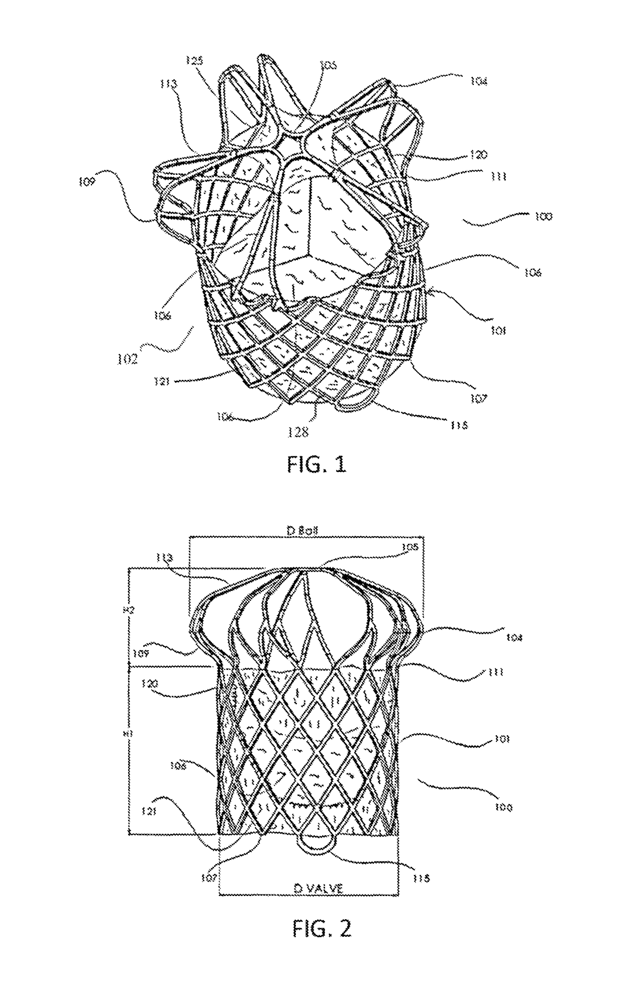 Transcatheter pulmonary ball valve assembly