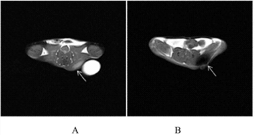 Magnetic resonance imaging detectable liquid embolism composition and preparation and application thereof