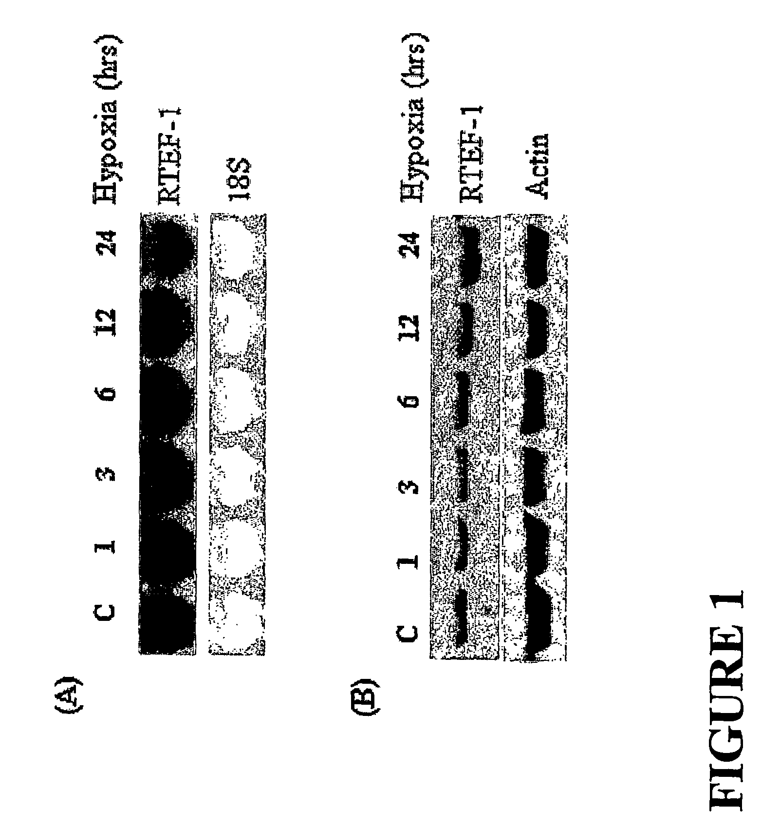 Methods and compositions for treating conditions involving abnormal angiogenesis