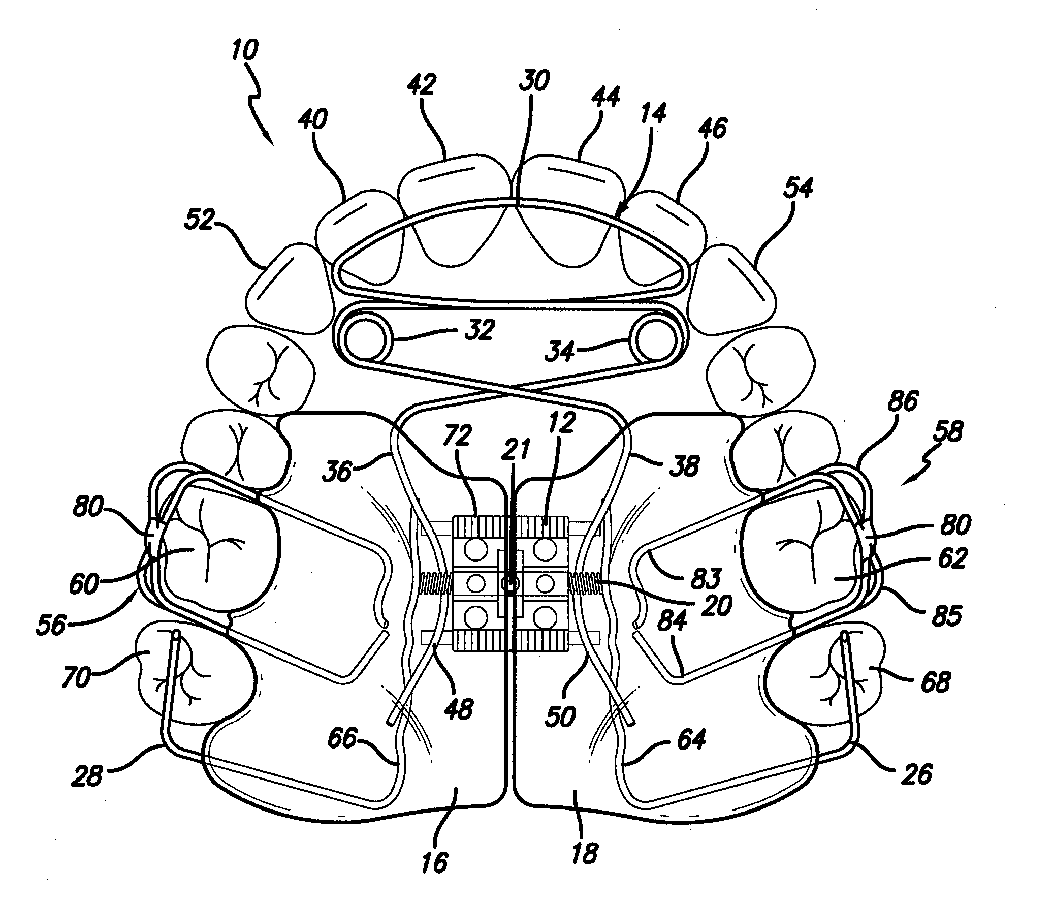 Orthodontic appliance