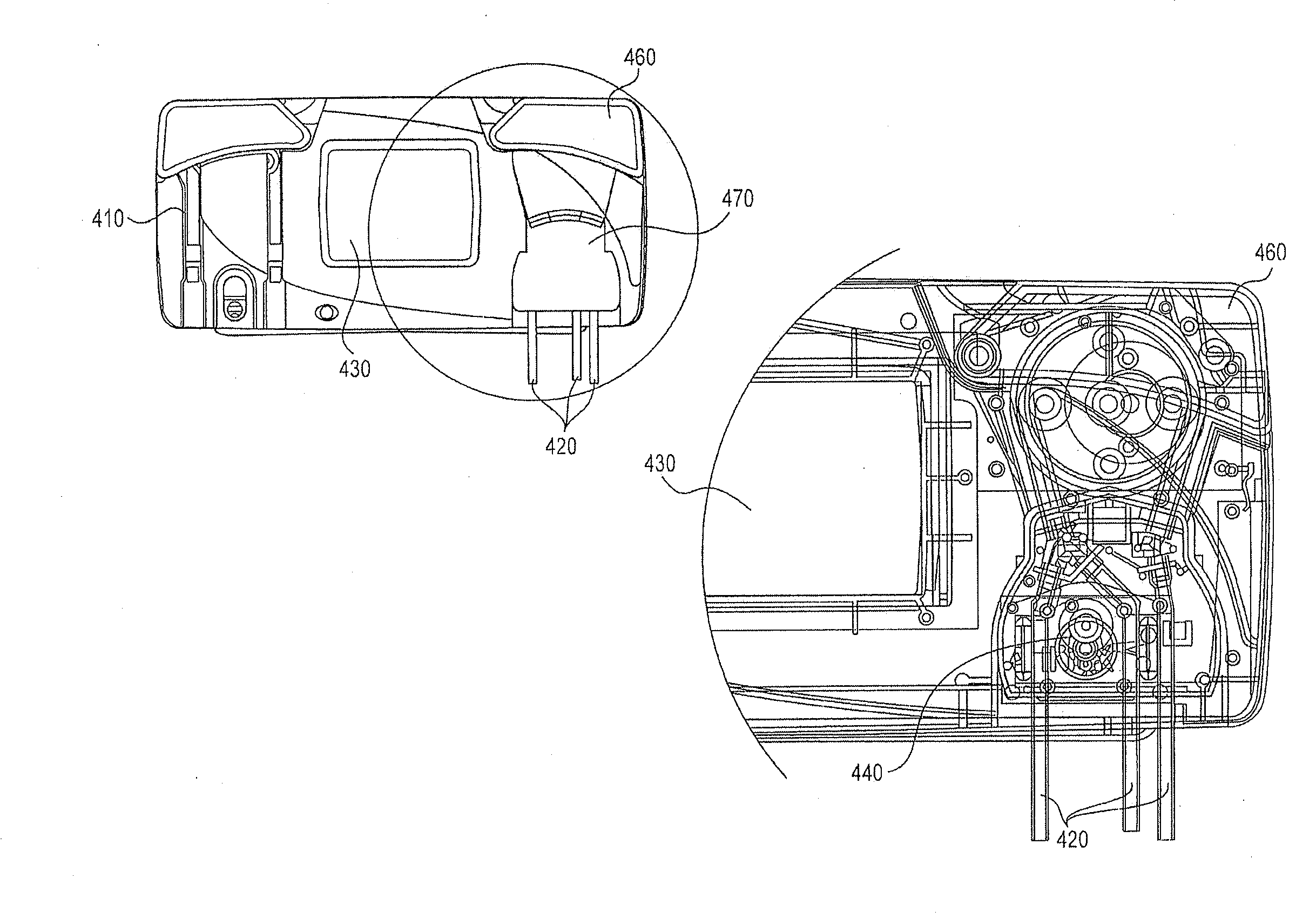 Fluid management system