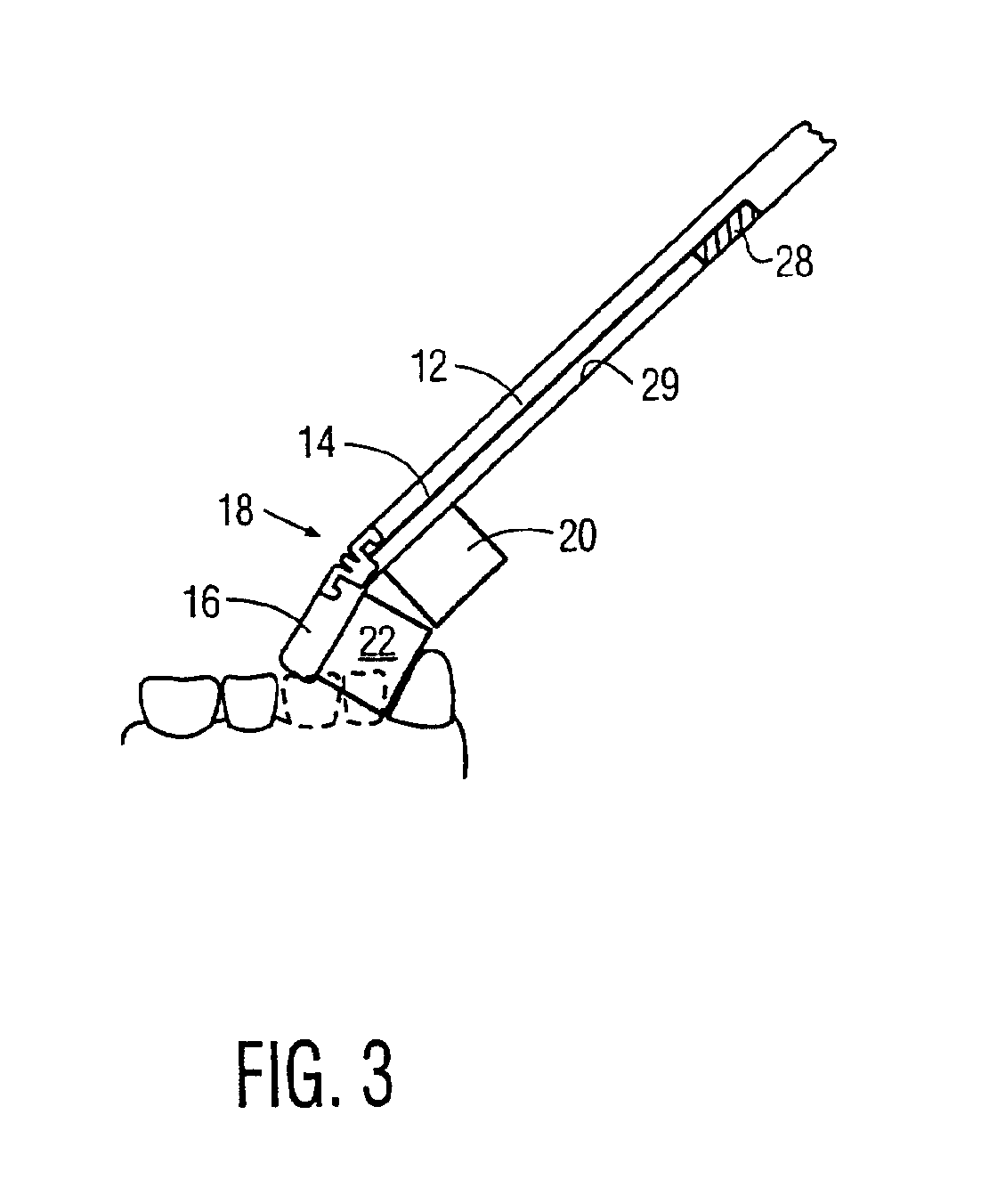 Contouring toothbrush head