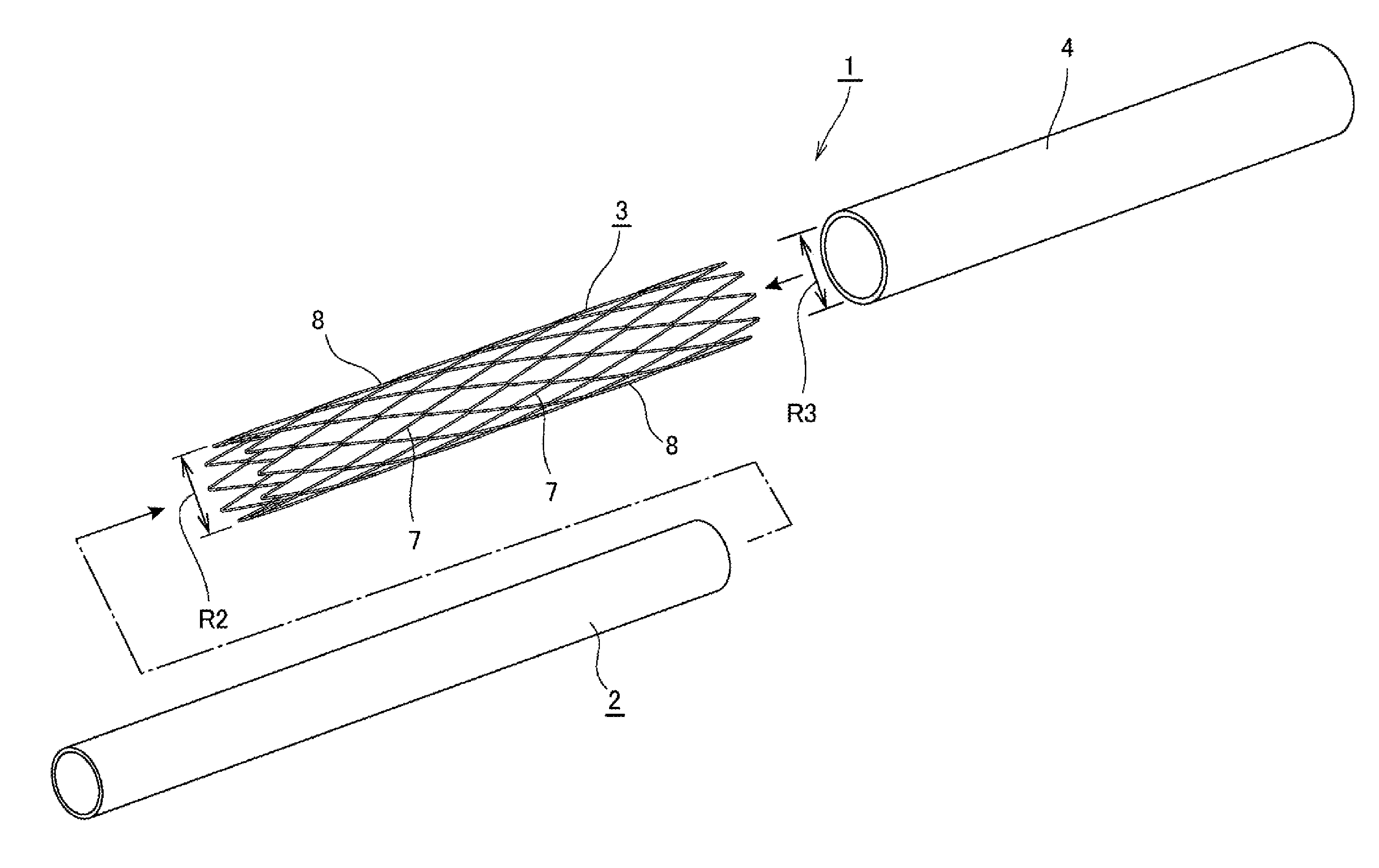 Stent apparatus