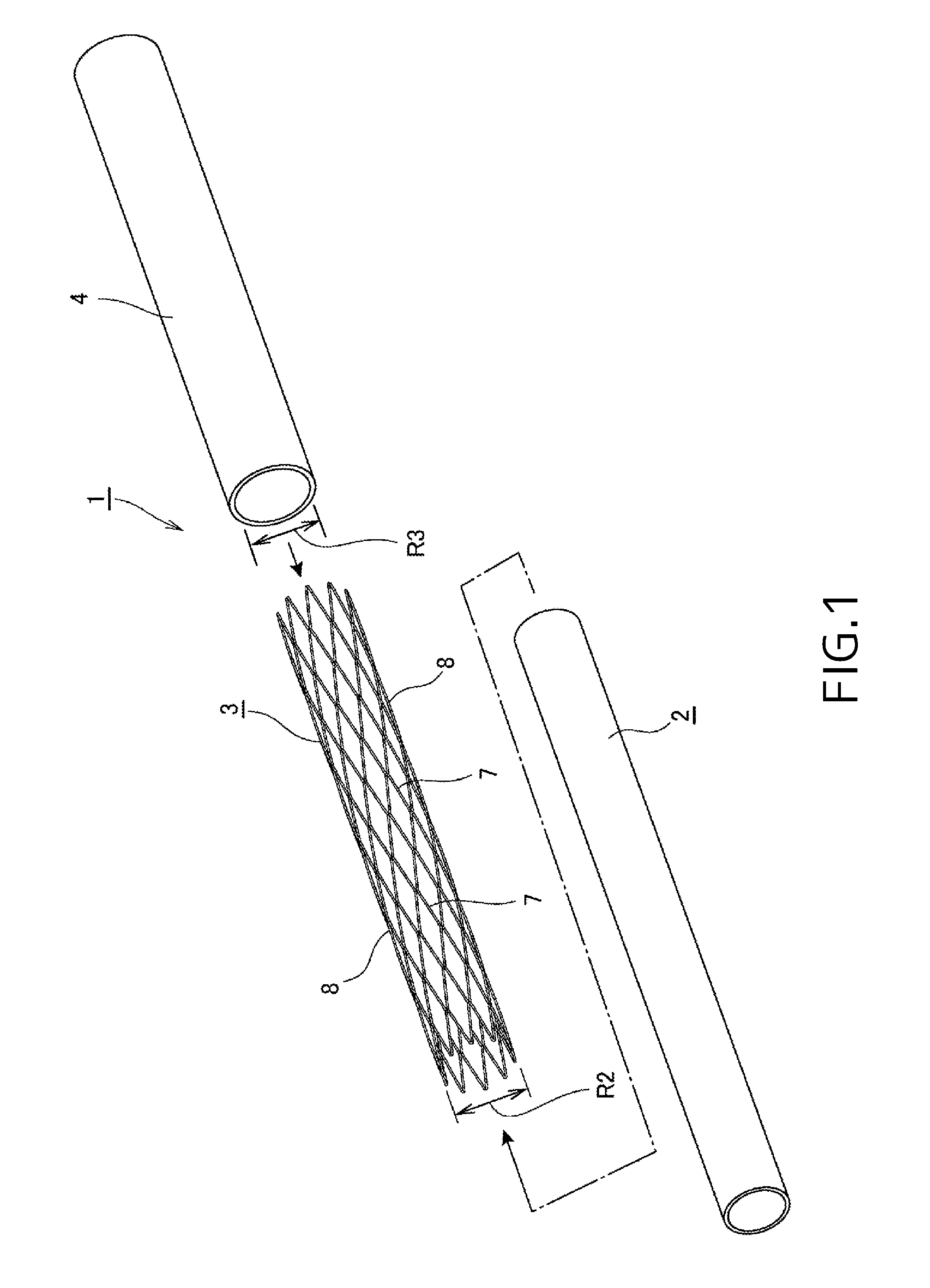 Stent apparatus