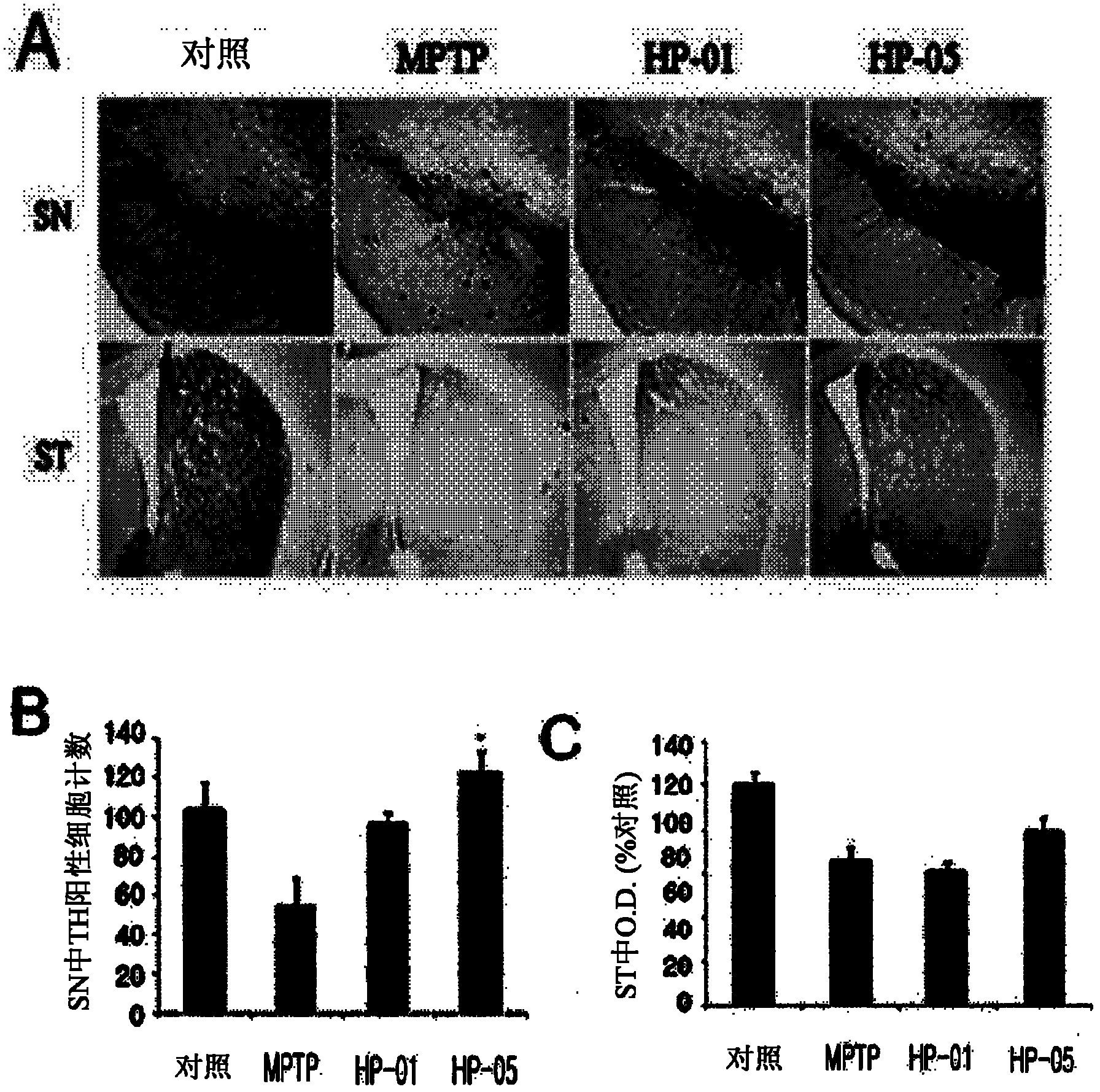 Composition comprising the purified extract of bee venom for preventing and treating degenerative brain diseases