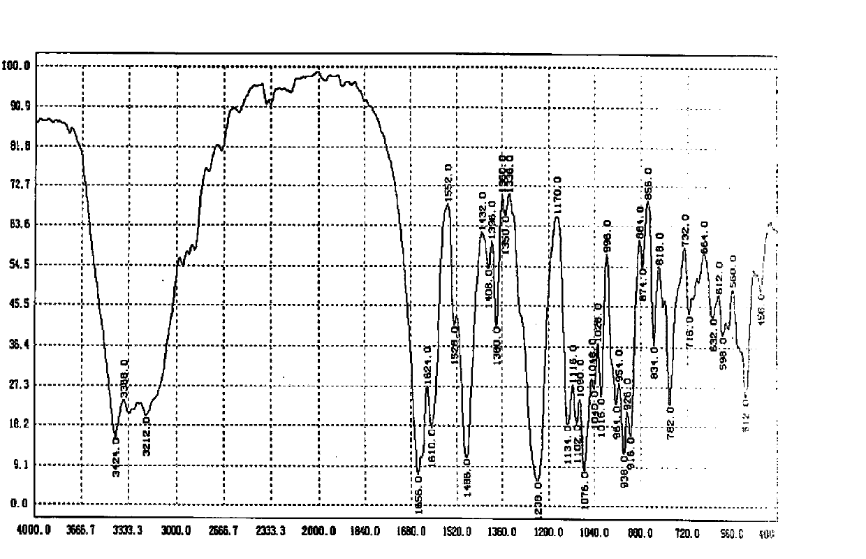 Method for catalytically producing citicoline sodium with immobilized enzyme