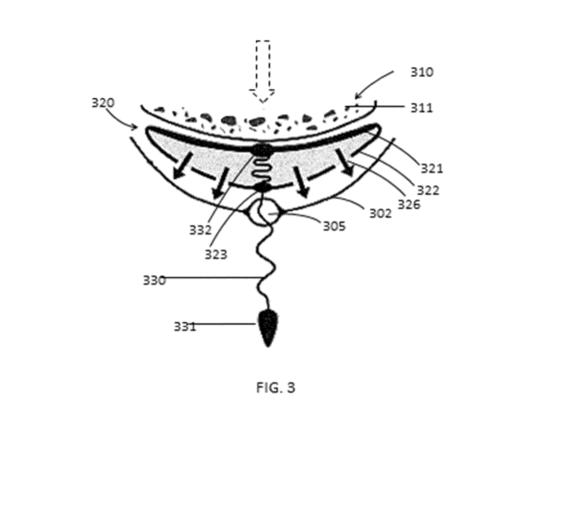 Retrieval of Biological Materials from the Human Uterus, Ovary and Cervix by Suction