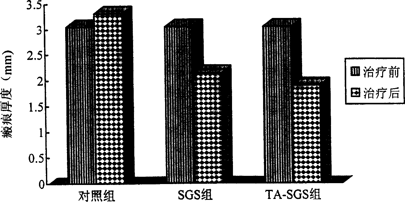 Anti-scar drug film and its preparing method