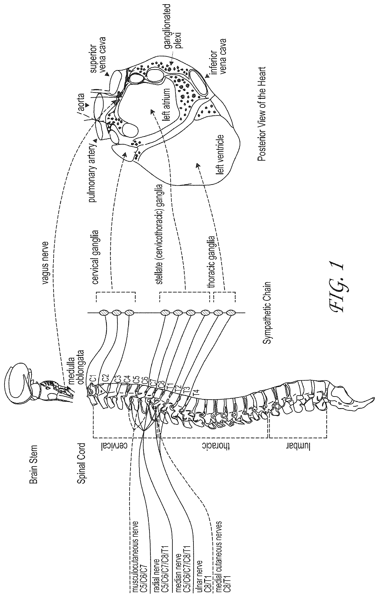 Systems and methods for treating cardiac dysfunction through peripheral nerve stimulation