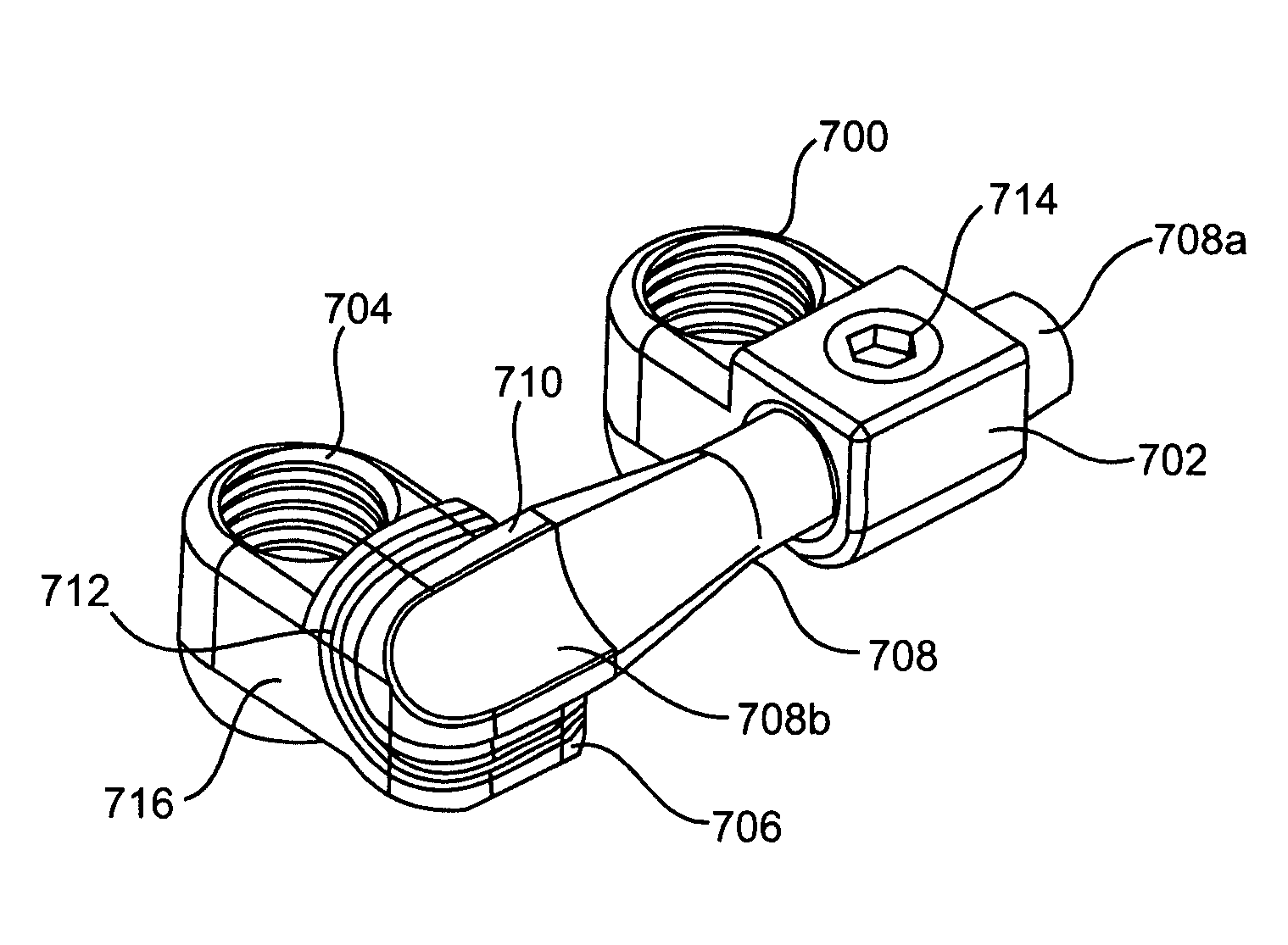 Systems and methods for posterior dynamic stabilization of the spine