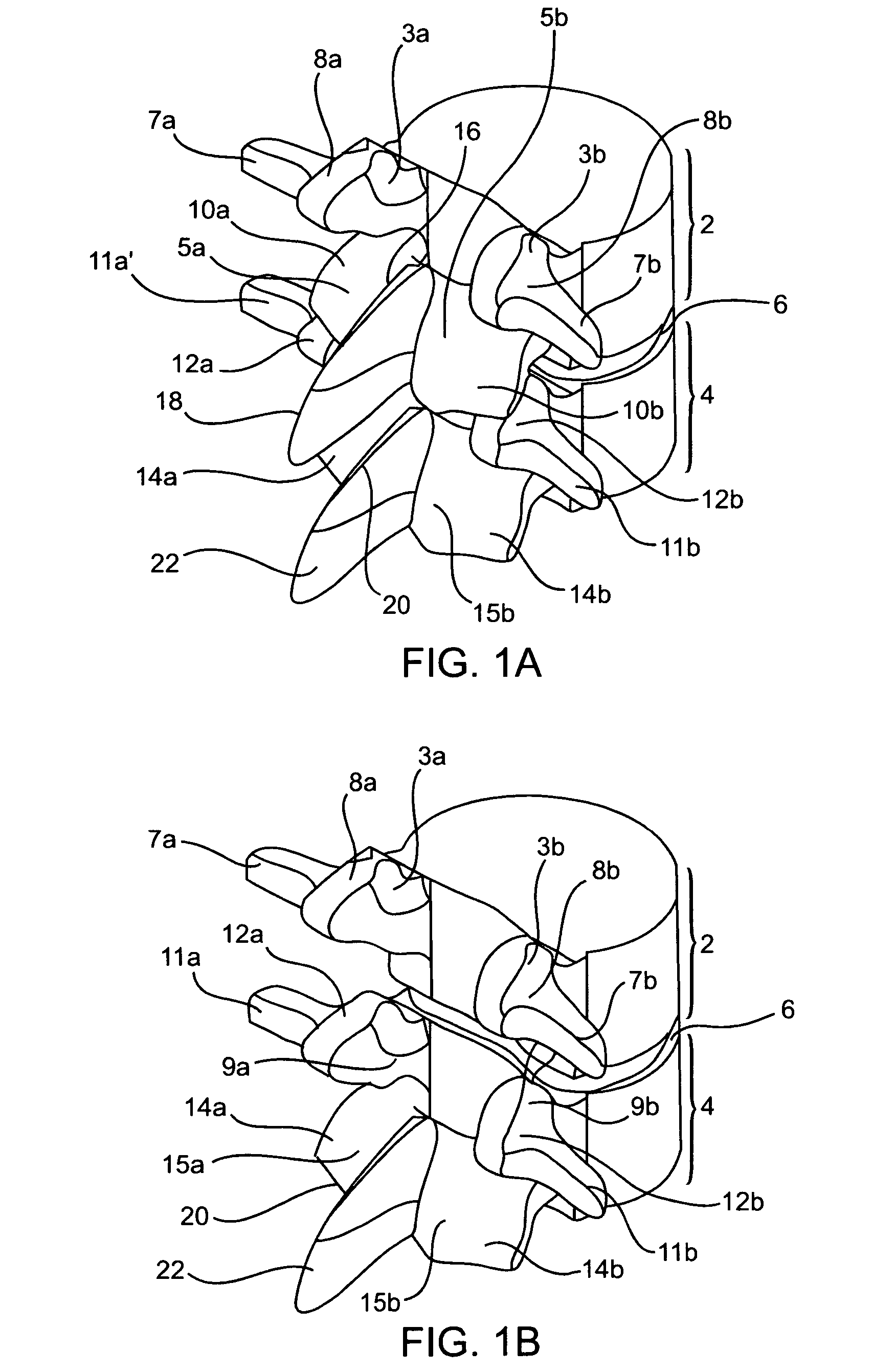 Systems and methods for posterior dynamic stabilization of the spine