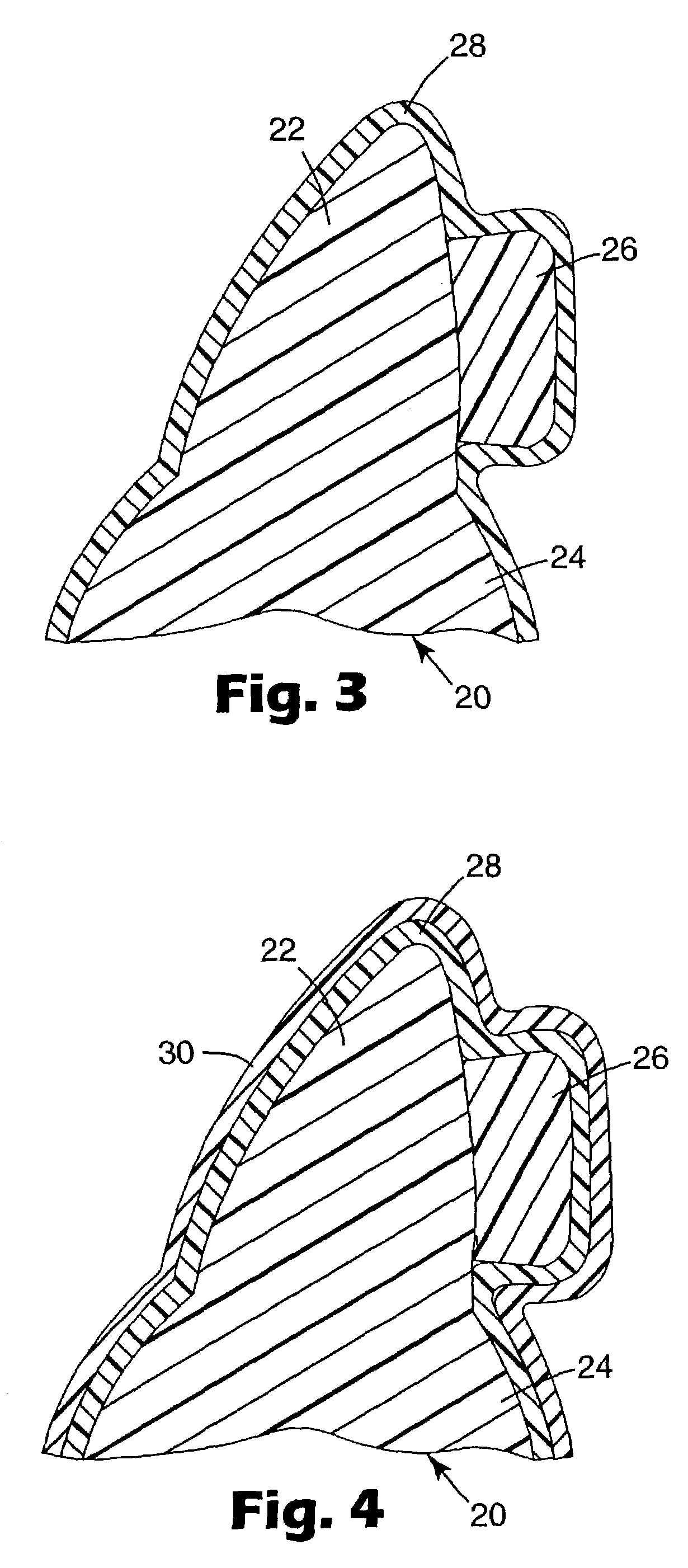 Orthodontic appliances having a contoured bonding surface