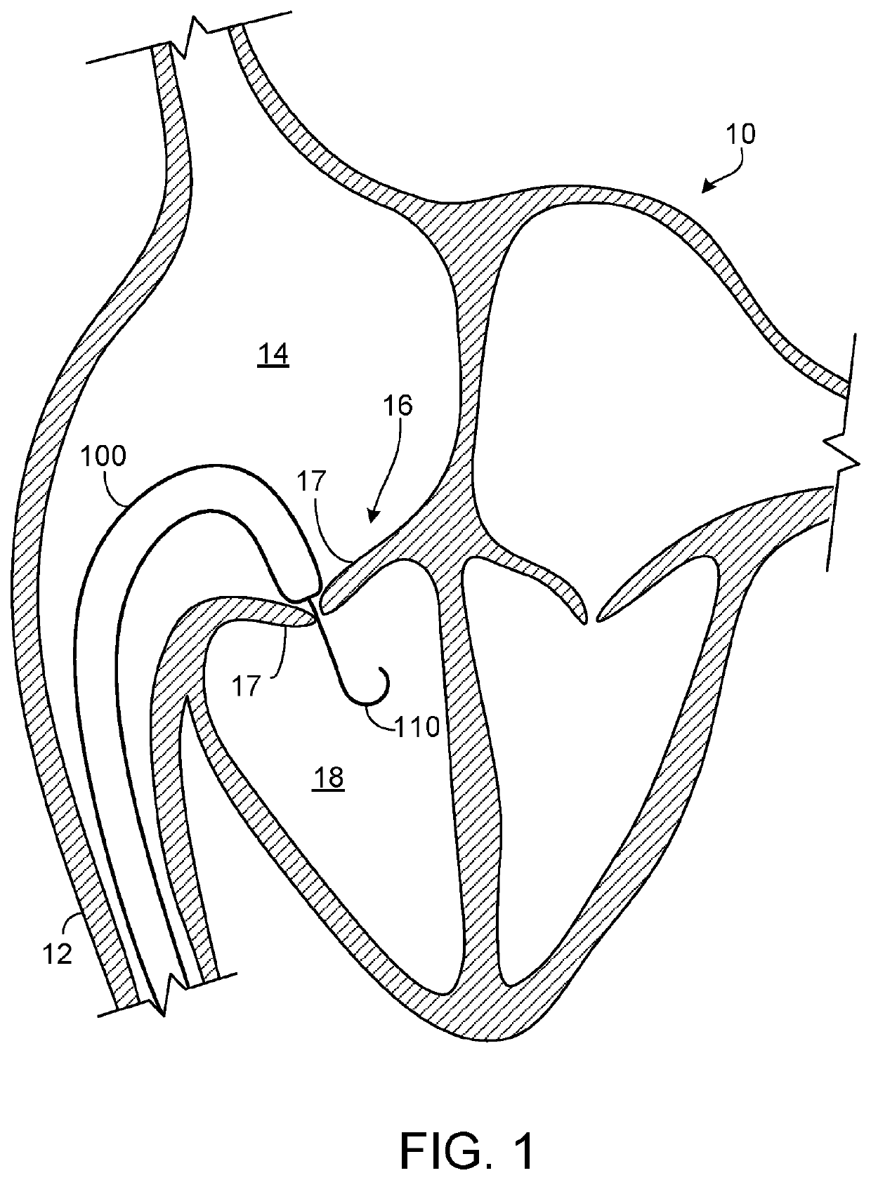 Percutaneously-deployable prosthetic tricuspid valve