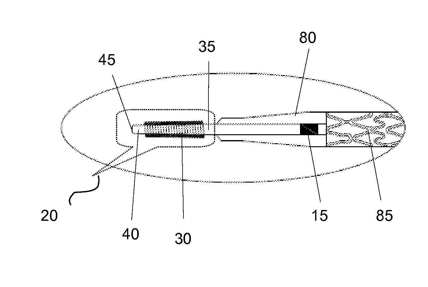 Catheter tip assembled with a spring