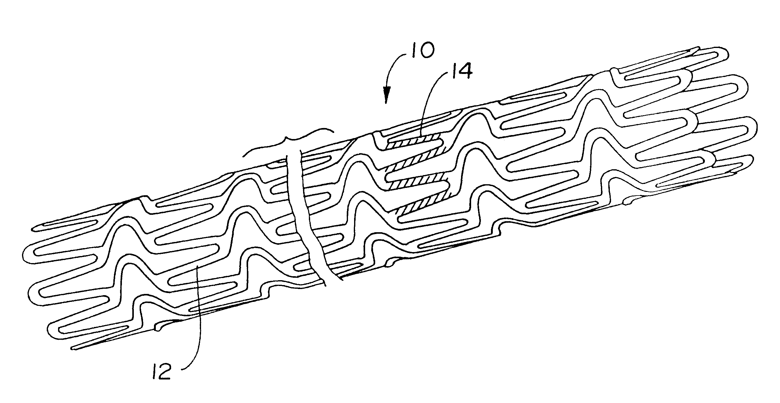 Magnetic stent