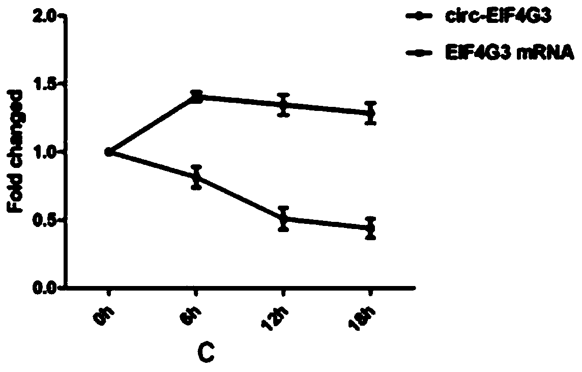 Application of novel gastric cancer marker circ-EIF4G3