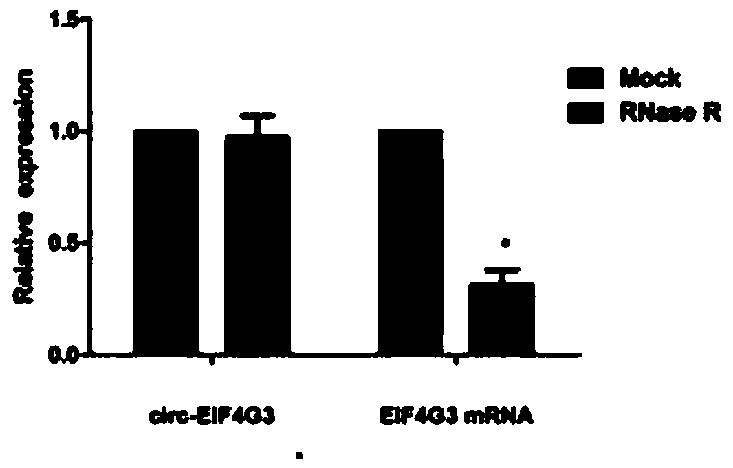 Application of novel gastric cancer marker circ-EIF4G3