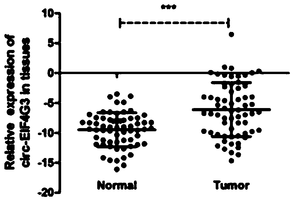 Application of novel gastric cancer marker circ-EIF4G3