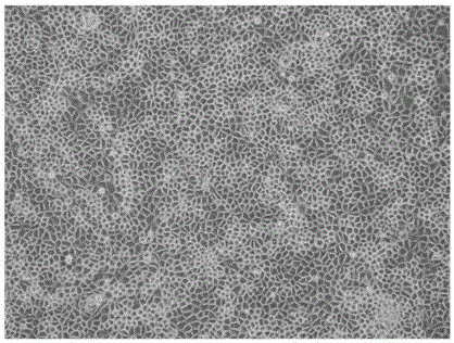 Swine testicular cell strain ST-S suitable for suspension culture as well as acquisition method and application of swine testicular cell strain ST-S