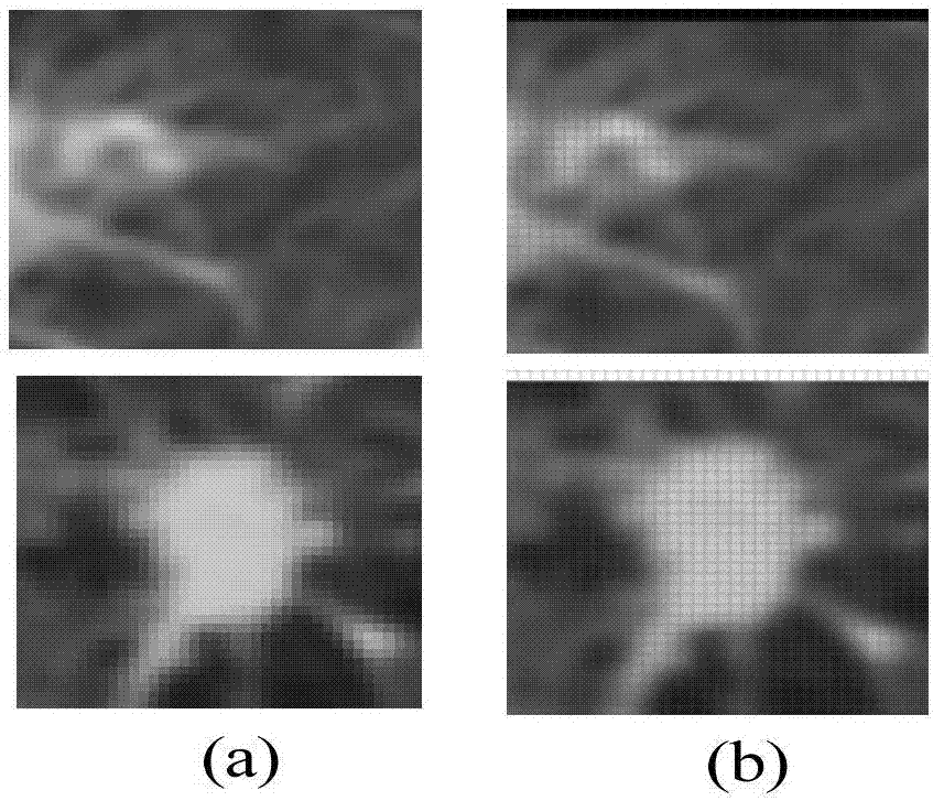 Pulmonary nodule diagnosis method based on local receptive field and semi-supervised depth self coding