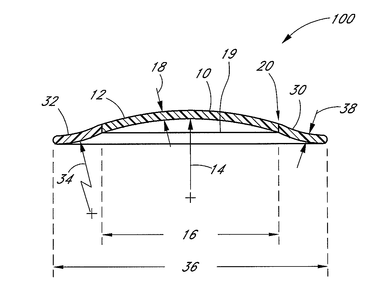 Hybrid contact lenses prepared with expansion controlled polymeric materials