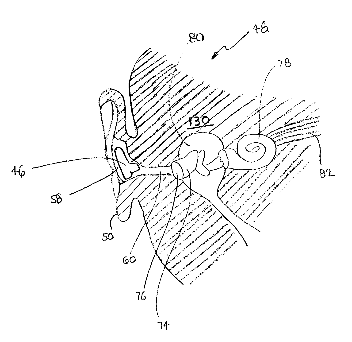 Infant monitoring system with removable ear insert