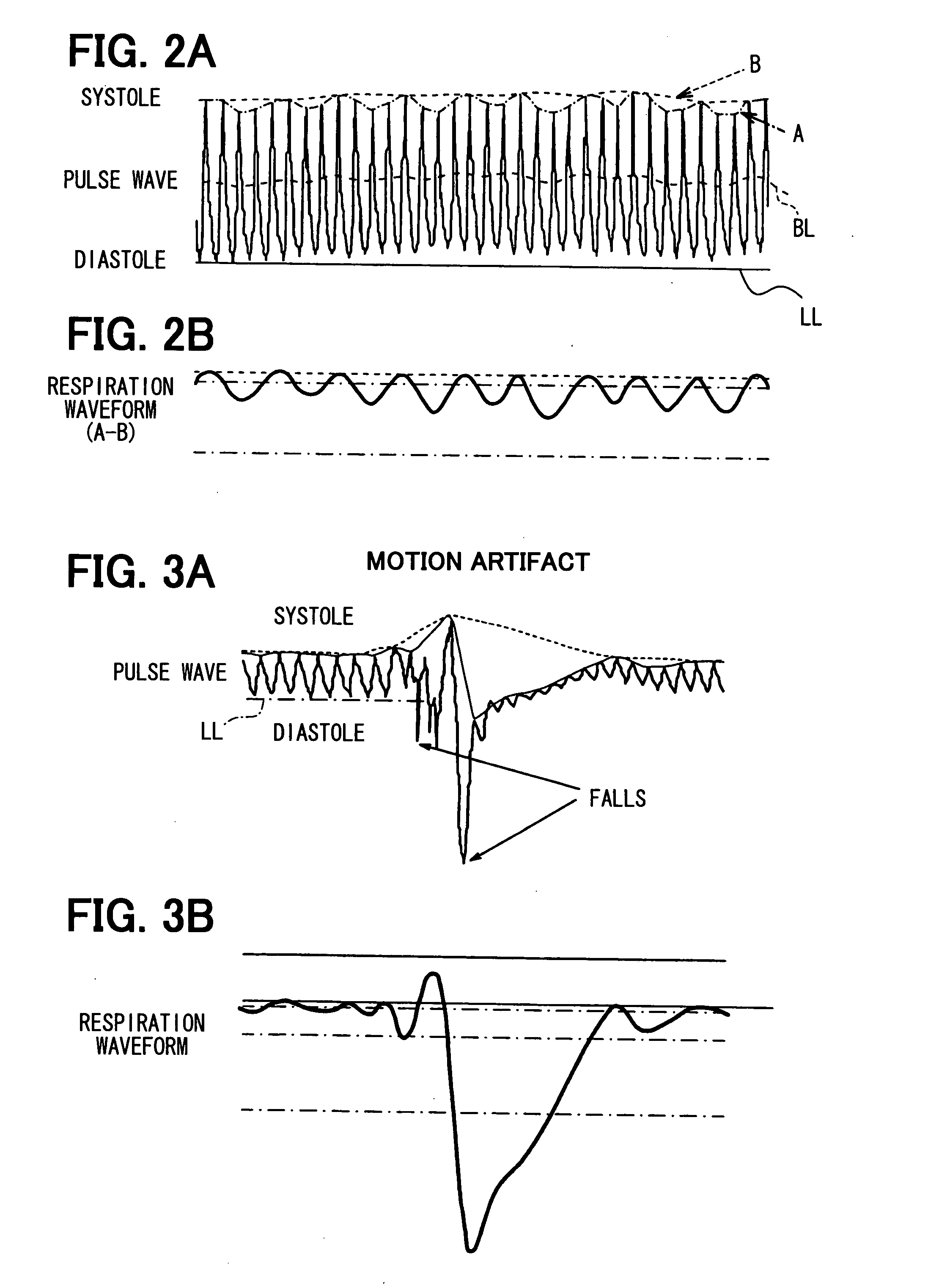 Apparatus for detecting vital functions, control unit and pulse wave sensor