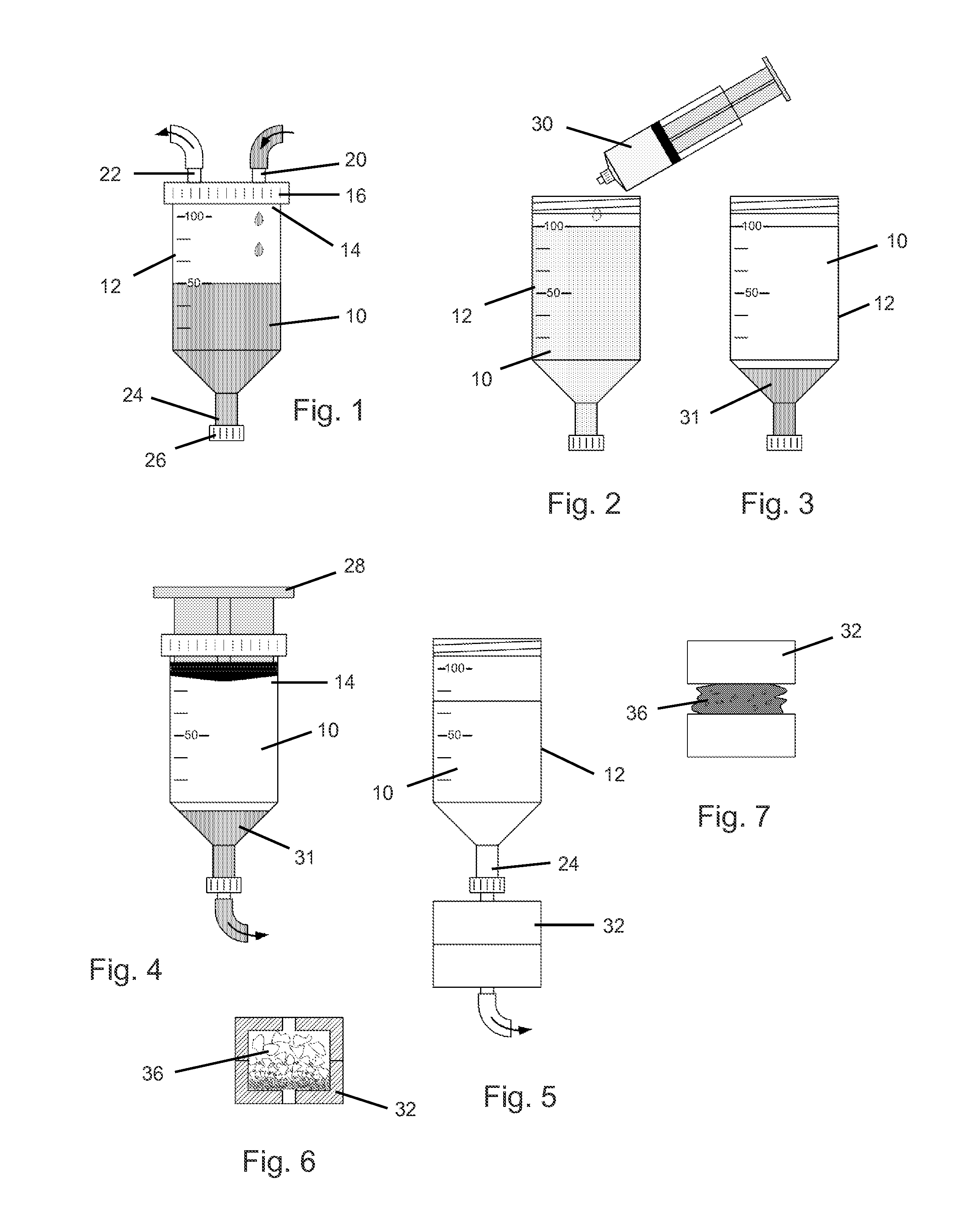 Bone marrow aspirate enhanced bone graft