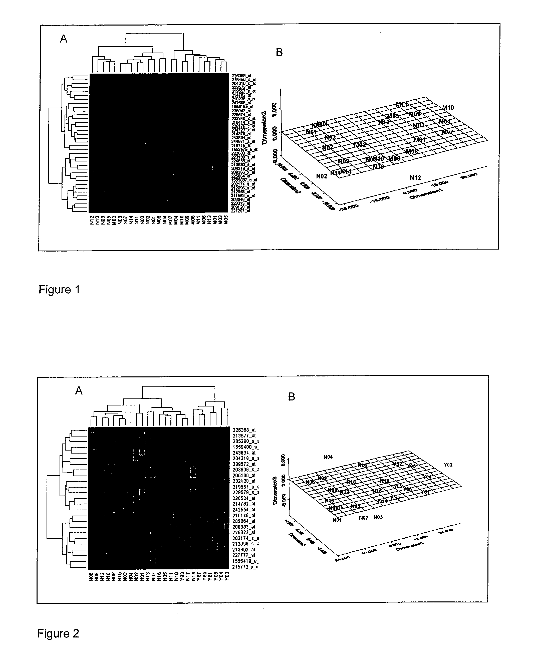 Biomarkers for oral tongue cancer metastasis and extracapsular spread (ECS)