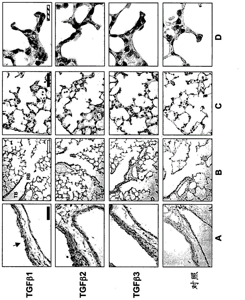 Use of TGF-BETA antagonists to treat infants at risk of developing bronchopulmonary dysplasia