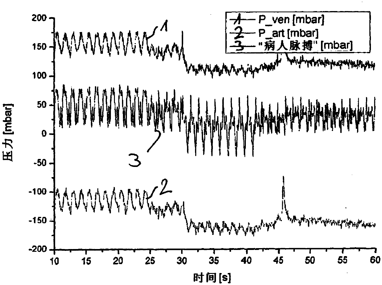 Method for monitoring an extracorporeal blood treatment and device for carrying out the method