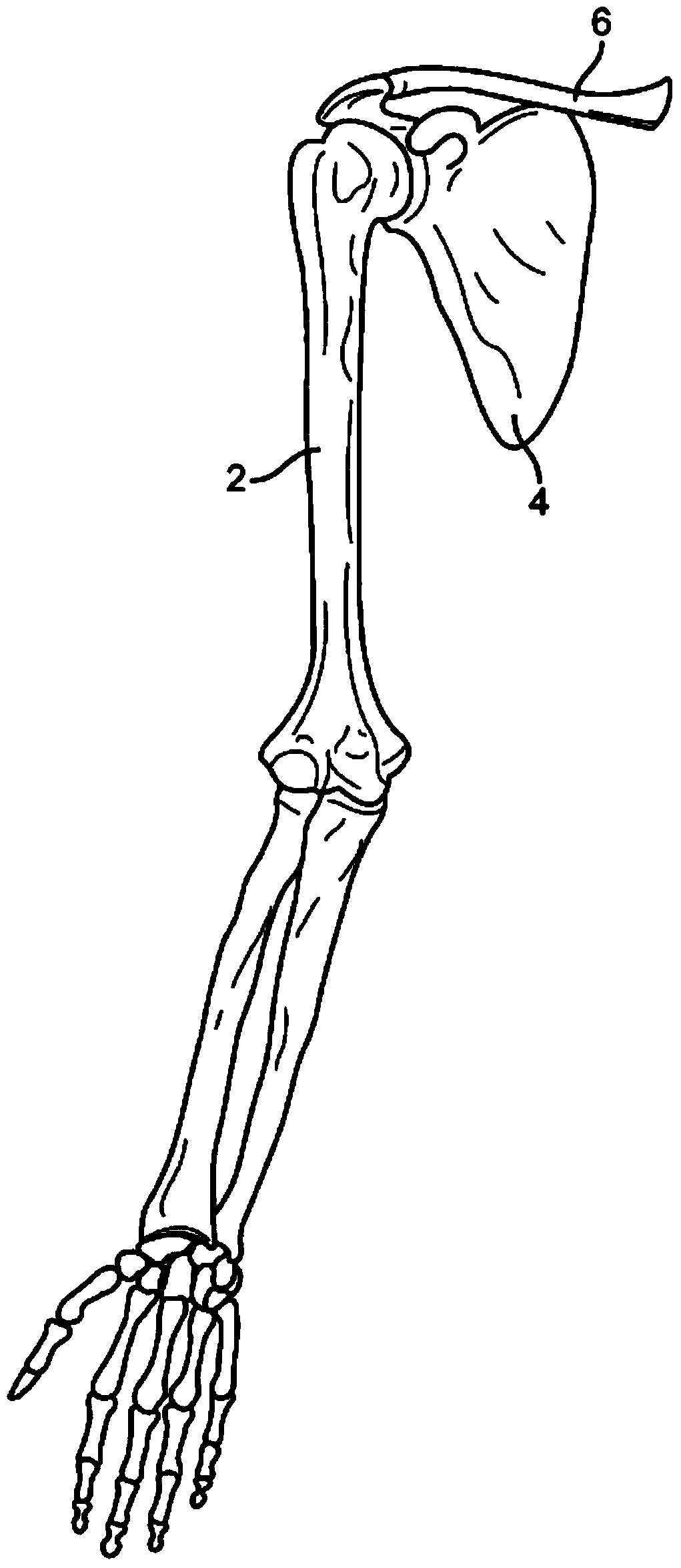 System for surgical tool tracking