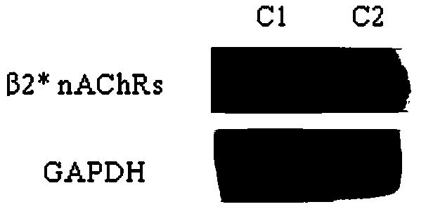 Method for determining expression quantity of nicotine acetylcholine receptors in rat lymphocytes