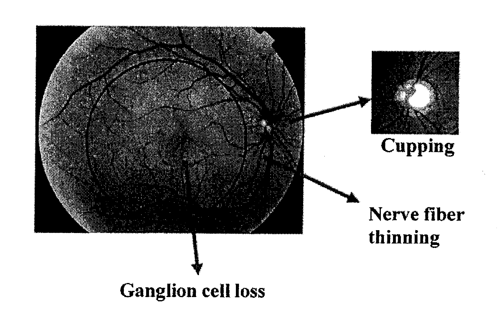 Methods for Diagnosing Glaucoma Utilizing Combinations of FD-OCT Measurements from Three Anatomical Regions of the Eye