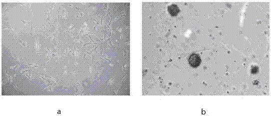 A kind of induction medium and method for inducing human adipose-derived mesenchymal stem cells to generate insulin-secreting cells