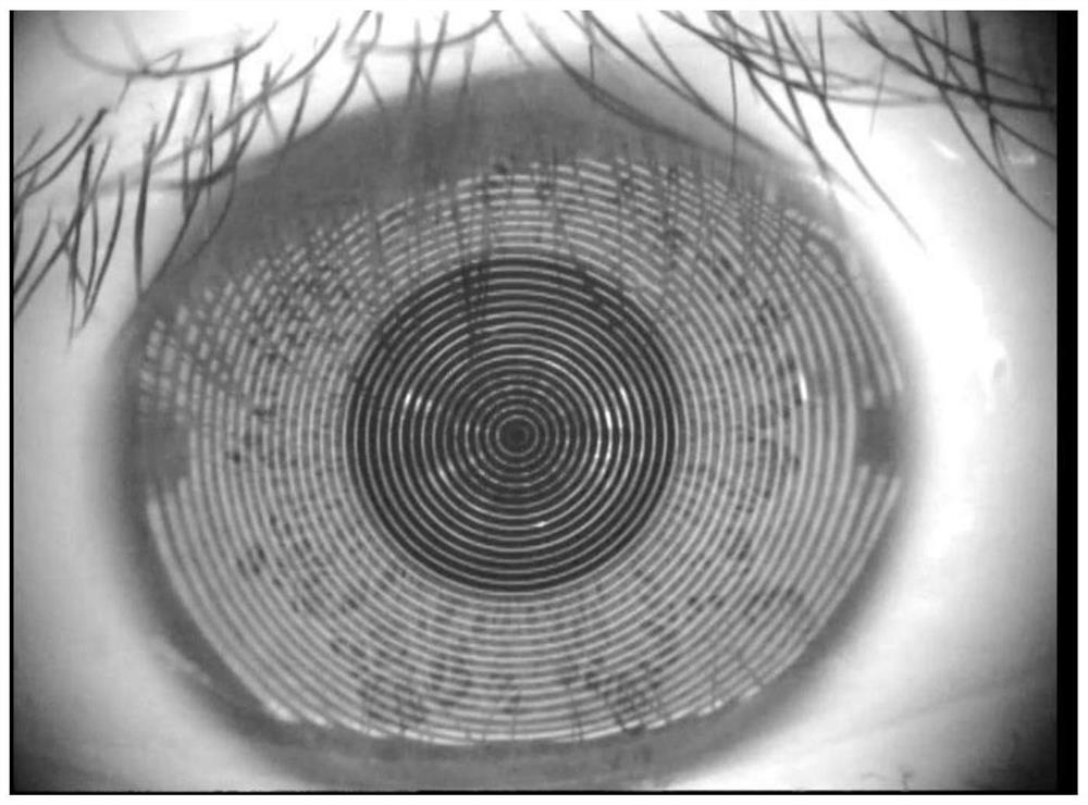 Corneal image point cloud selection method and system, intelligent terminal and storage medium