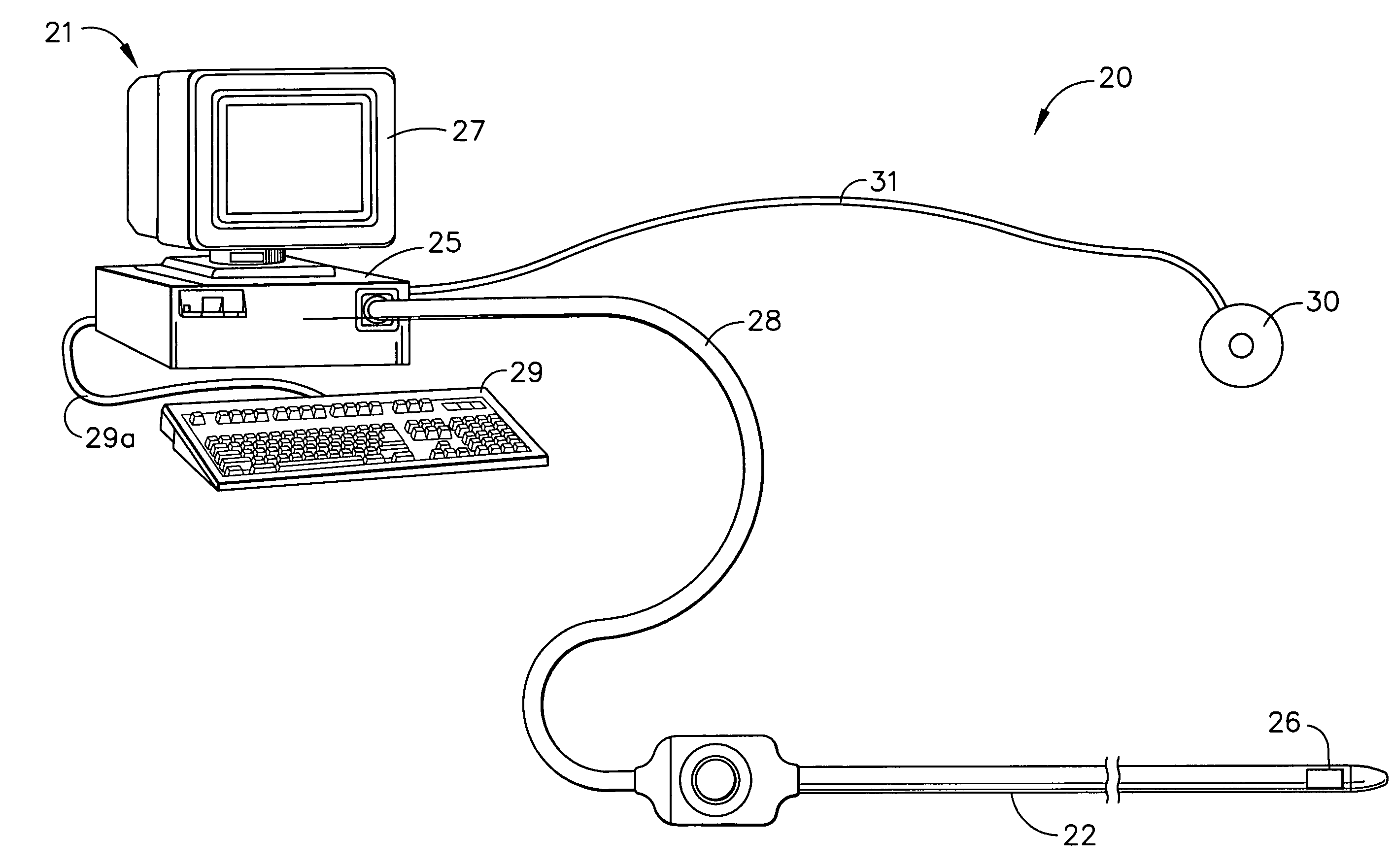 Medical system calibration with static metal compensation