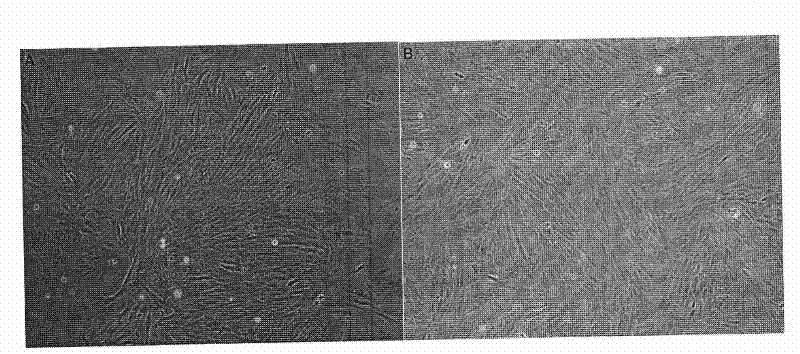 Method for constructing kidney cell line of scophthalmus maximus