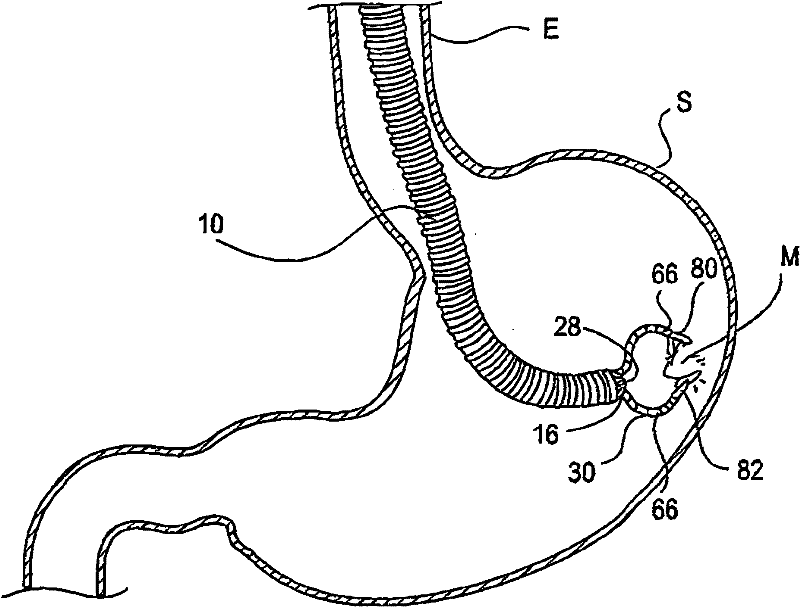 Internal viewing device with high degree of freedom of movement and method of operation thereof