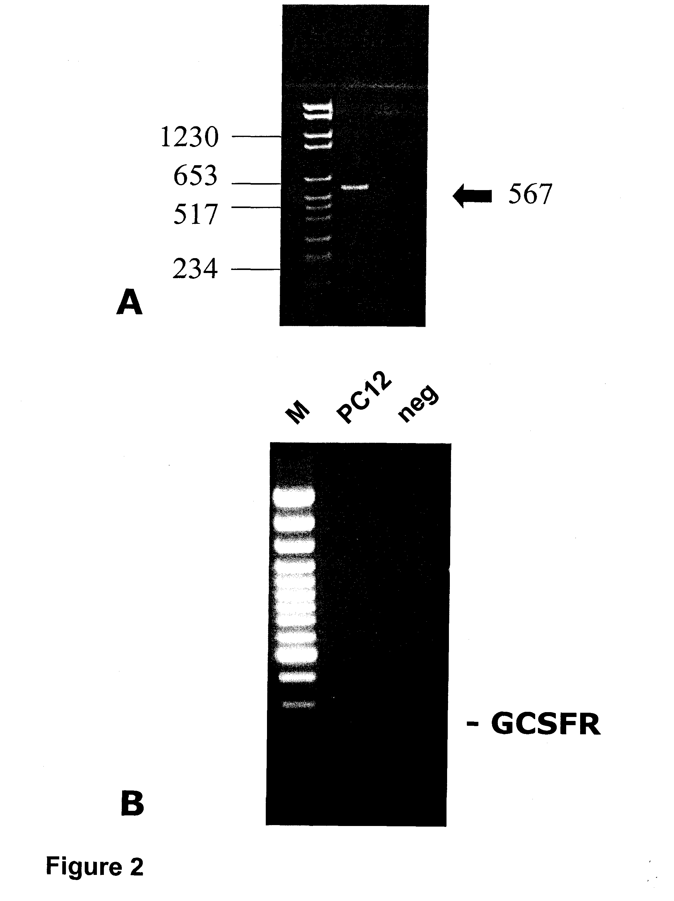 Methods of treating neurological conditions with hematopoeitic growth factors