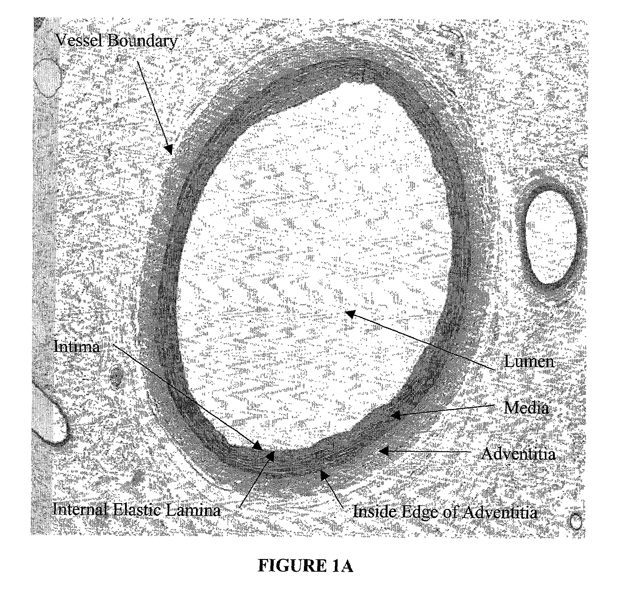 Method for quantitative analysis of blood vessel structure