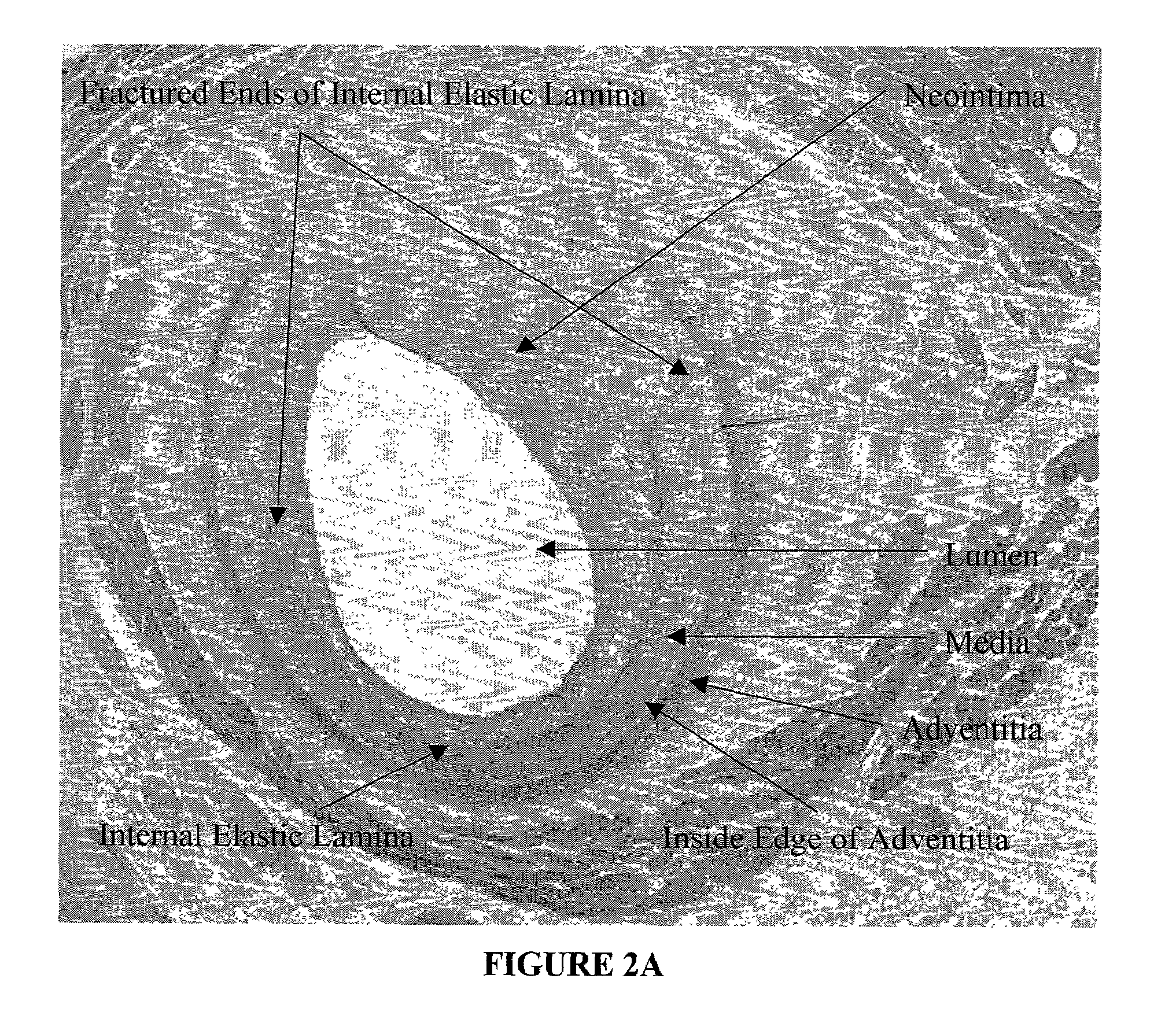 Method for quantitative analysis of blood vessel structure