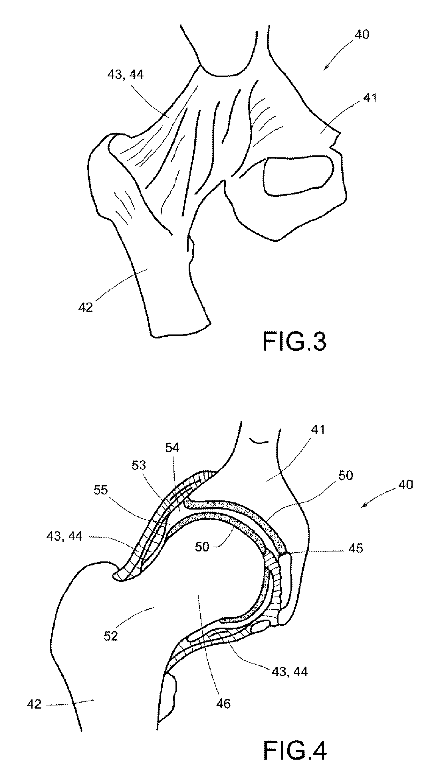 Device for arthroscopic use, and method of diagnosis or treatment of joint ailments using said device