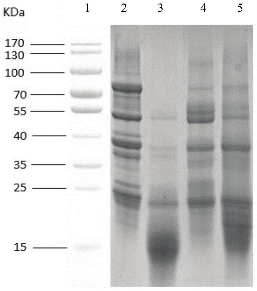 Nucleic acid aptamer for specifically recognizing soybean antigen beta-conglycinin