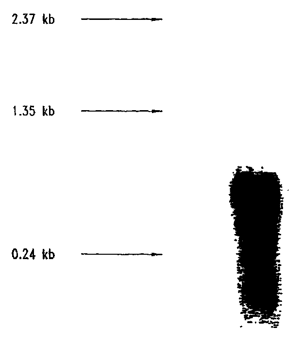 Compositions and methods for the therapy and diagnosis of breast cancer