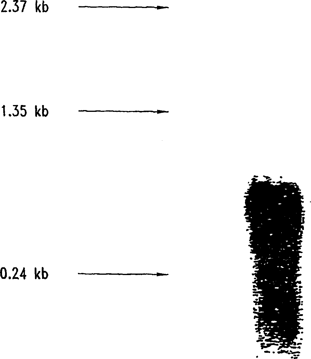 Compositions and methods for the therapy and diagnosis of breast cancer