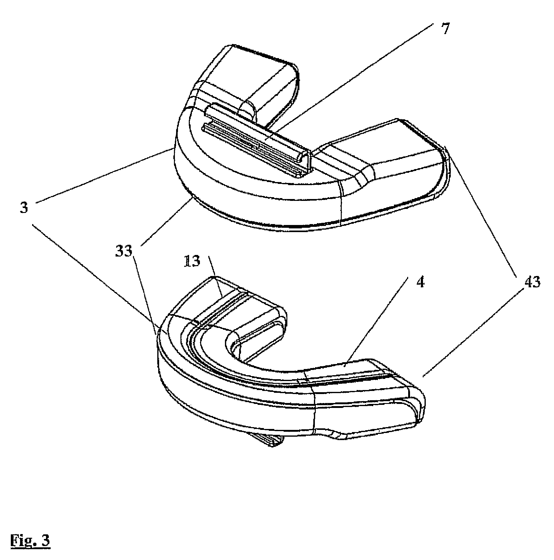 Continuously adjustable mandibular protrusion splint for treating snoring and obstructive sleep apnea